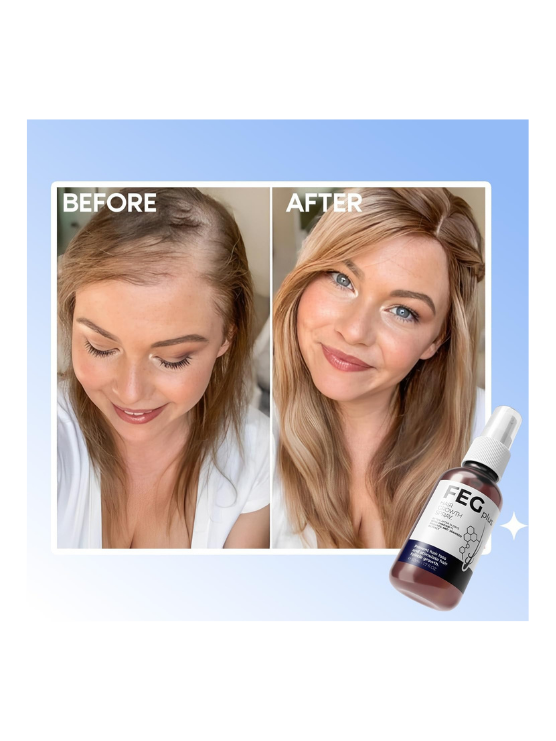 FEGPlus Minoxidil Beard & Hair Growth Serum